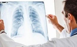 Zatürre belirtileri neler, nasıl bulaşır, hastalıktan nasıl korunabiliriz?