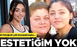 Ünlü oyuncunun değişimi dikkat çekmişti… ‘Estetiğim yok!’