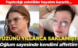 Yaptırdığı estetikler hayatını karartmıştı… Yıllarca yüzünü herkesten sakladı: Oğlum sayesinde artık kendimi affettim